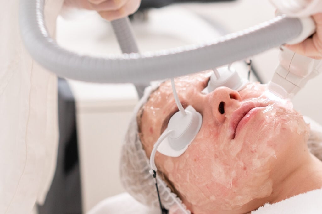 skin treatment for acne
