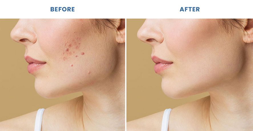 Young woman before and after