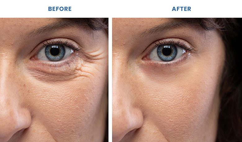 Young woman before and after