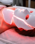 Is Red Light Therapy at Oxyderm Laser Clinic Worth It for Long Term Skin Health?