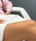 What Are the Top Benefits of Laser Skin Rejuvenation Near You at Oxyderm Laser Clinic?
