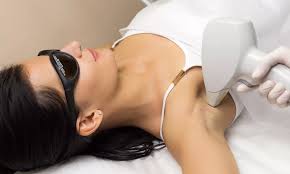 professional laser hair removal treatment