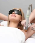 Which Advanced Technologies Does Oxyderm Laser Clinic Use for Hair Removal in Edmonton?