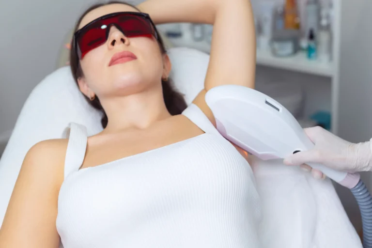 laser hair removal treatment