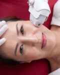 10 Essential Pre-Treatment Considerations for Optimal Results from Laser Skin Rejuvenation