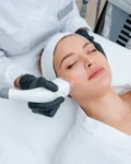 What Is Laser Genesis Treatment? Benefits, Skin Rejuvenation, and Redness Reduction Explained