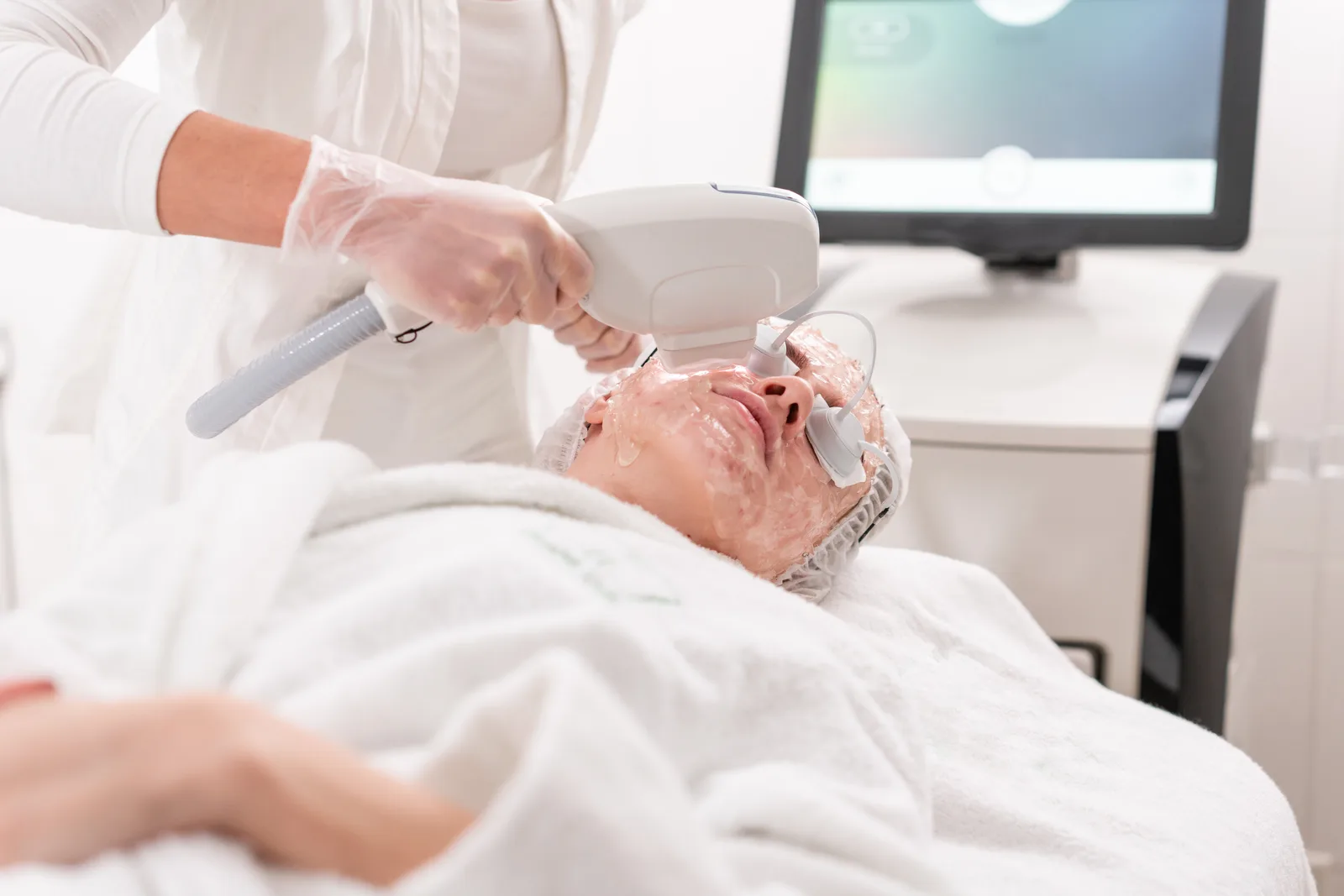 Acne Laser Treatment at Oxyderm Laser Clinic and Academy Edmonton