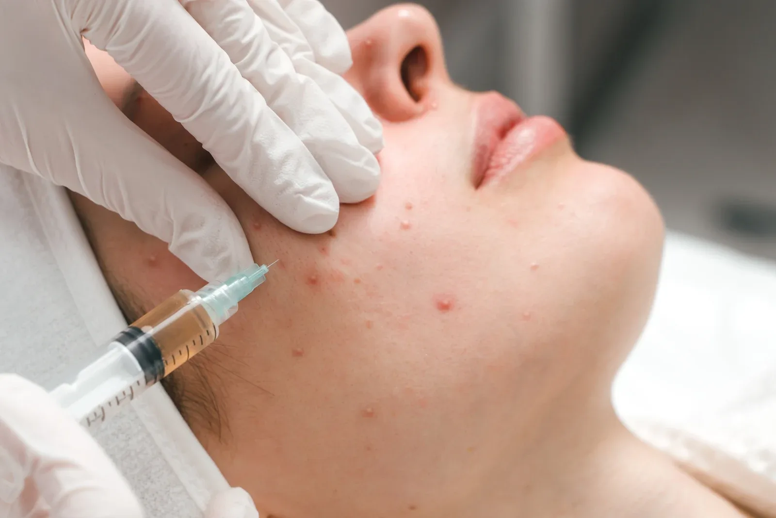 What a Spot Treatment Is Really Doing