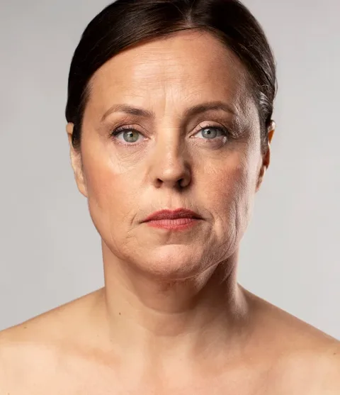 Before treatment