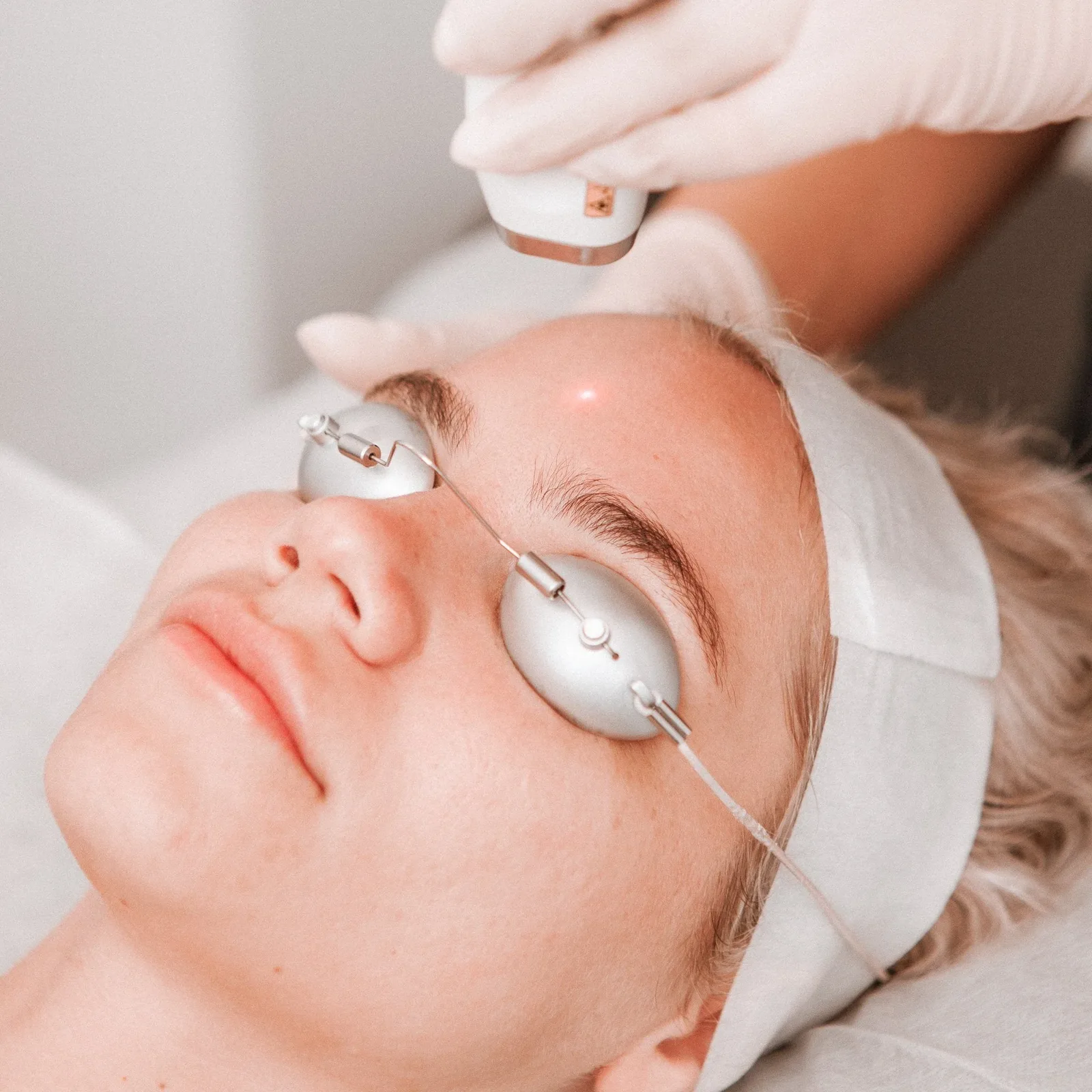 Laser Genesis results at Oxyderm Laser Clinic Edmonton
