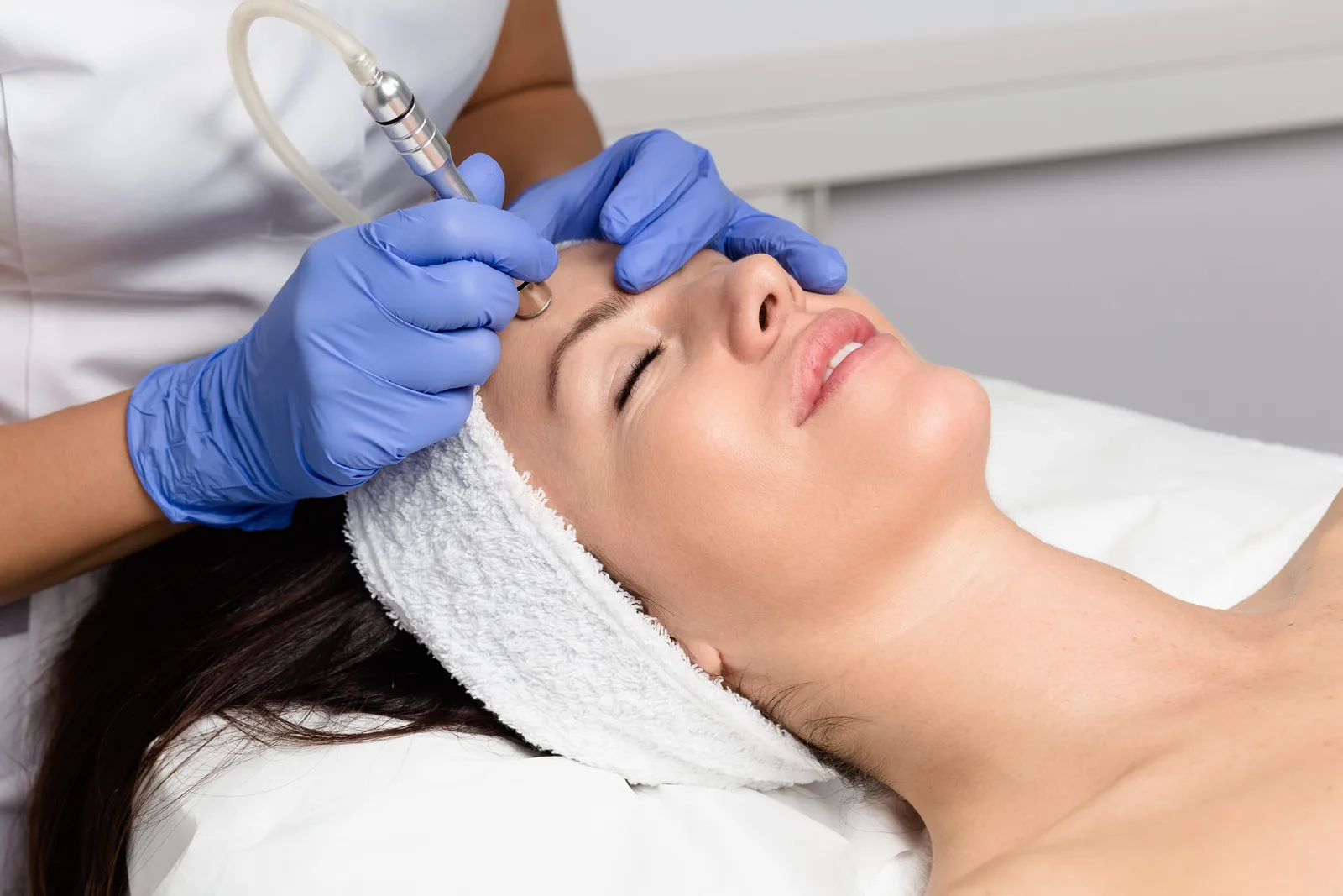 Microdermabrasion at Oxyderm Laser Clinic and Academy Edmonton