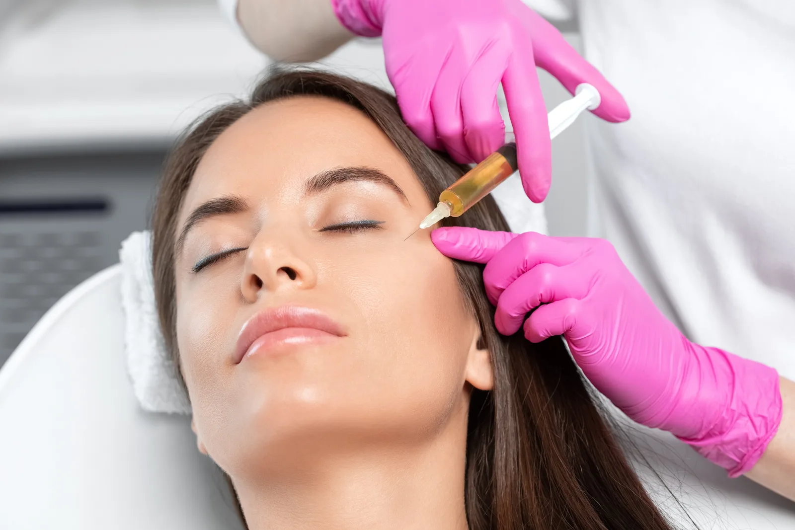 PRP Therapy at Oxyderm Laser Clinic Edmonton