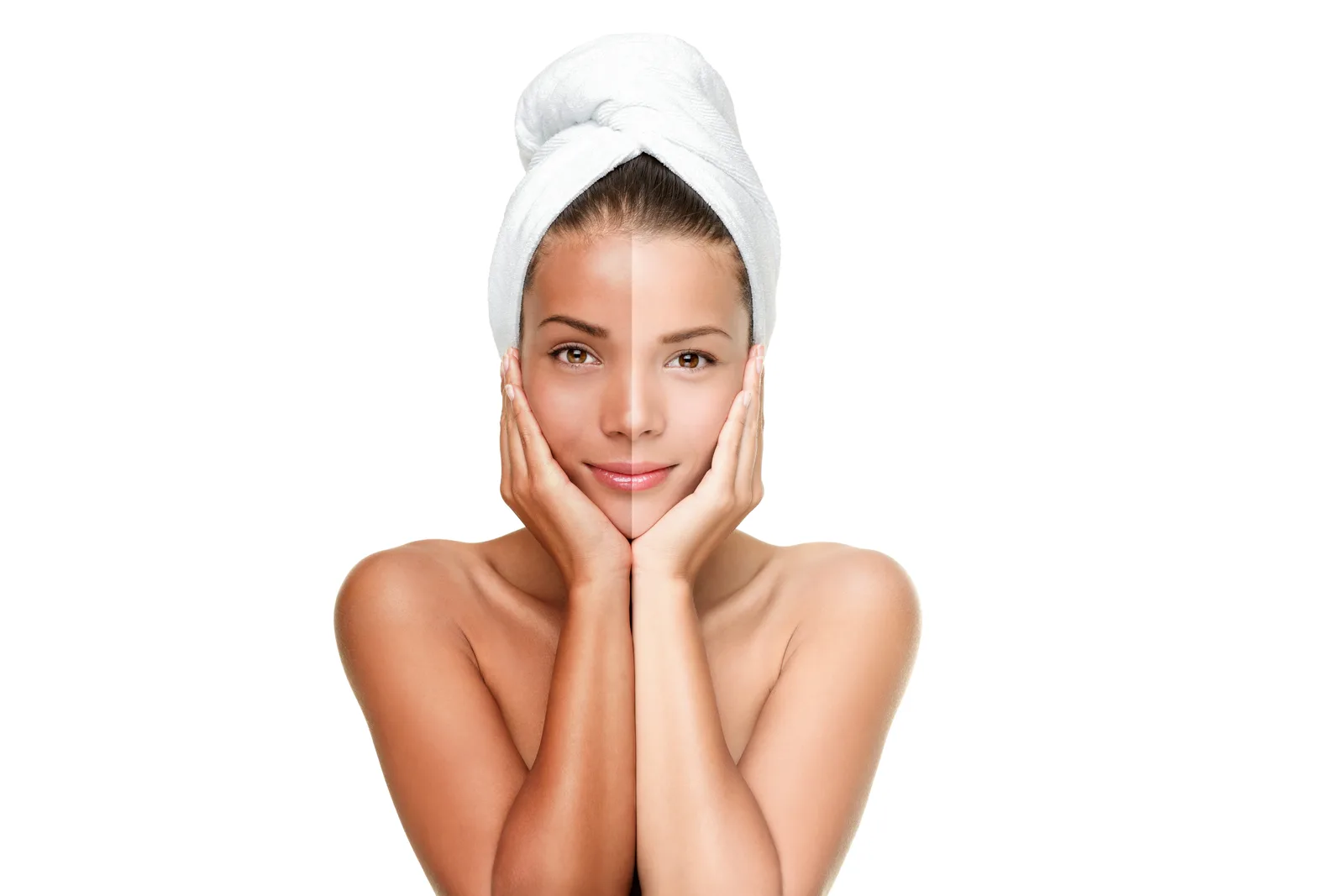Melasma vs. Sun Spots vs. Post-Acne Marks: How to Treat Each Type of Hyperpigmentation