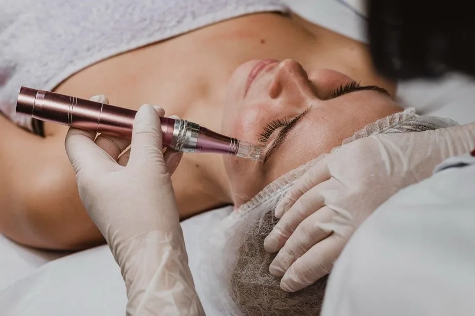 Microneedling Course at Oxyderm Laser Clinic Edmonton